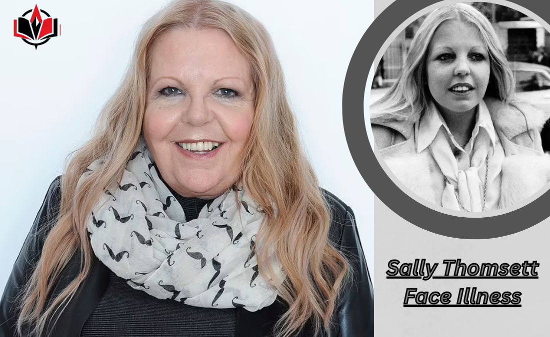Sally Thomsett Face Illness